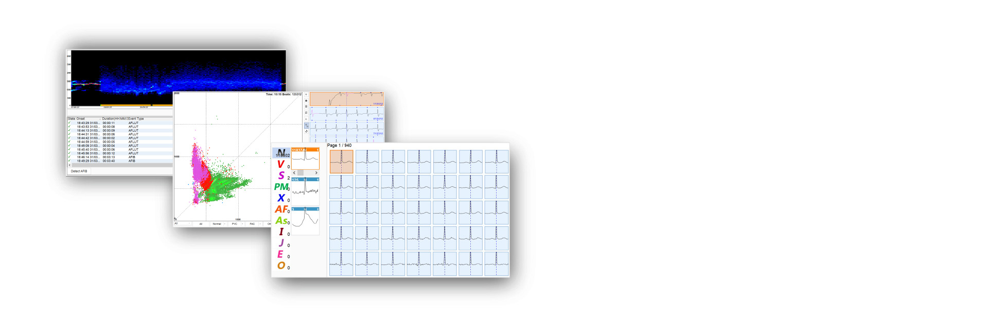 ECG Analysis Tools